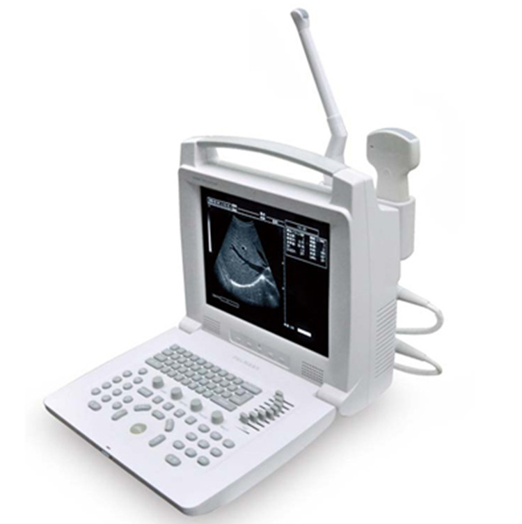 B/W Portable Ultrasound Scanner B/W Portable Ultrasound Scanner