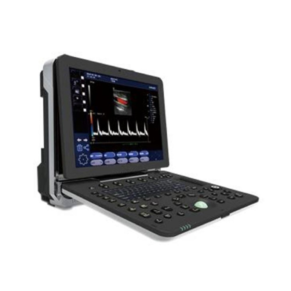 Portable Color Doppler Ultrasound