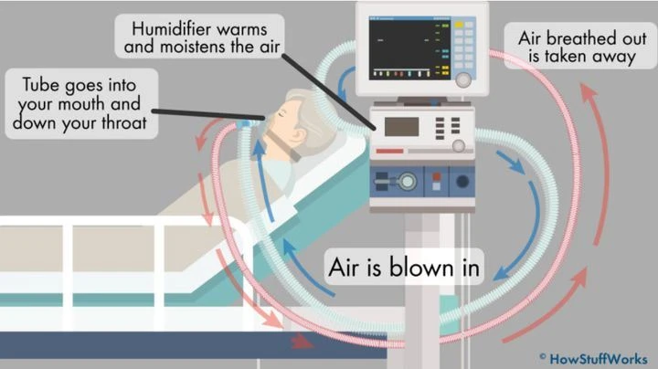 The basic design and function of the ventilator