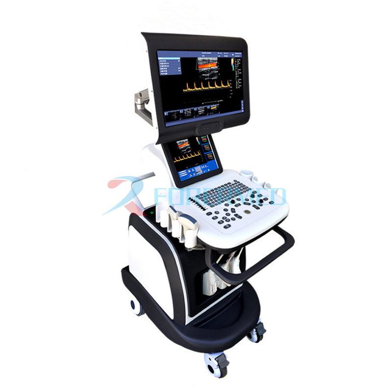 COLOR DOPPLER ultrasound COLOR DOPPLER ultrasound