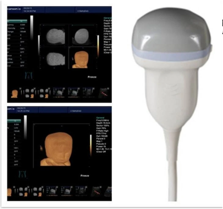 4D Color Doppler Ultrasound Diagnosis System