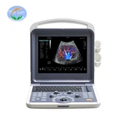 Baby Loptop ultraheli masin