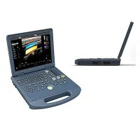 Sülearvuti värv Doppler ultraheli masin