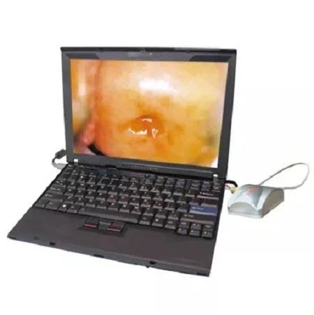 digital colposcope digital colposcope